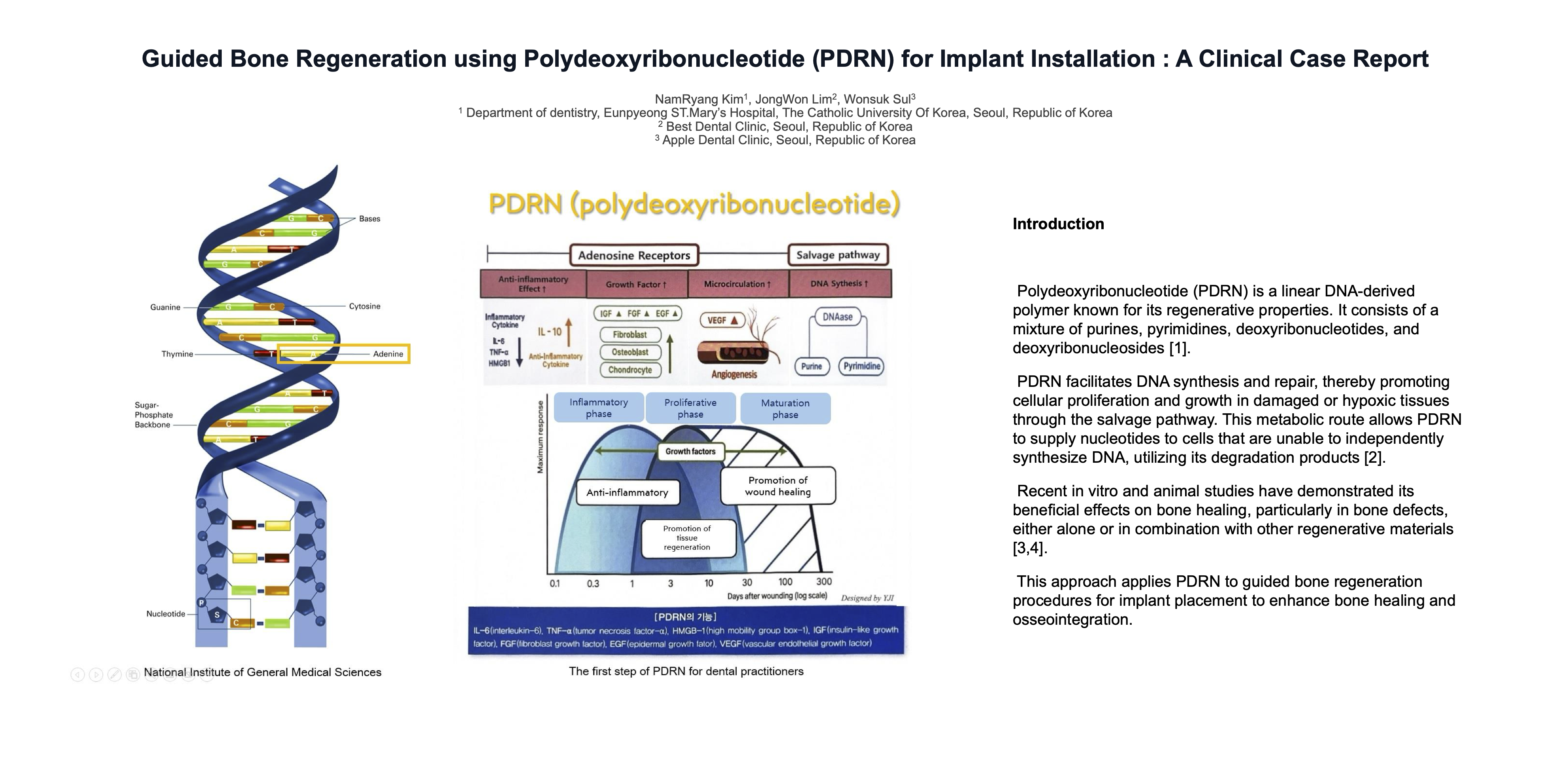 Guided Bone Regeneration using Polydeoxyribonucleotide (PDRN) for Implant Installation: A Clinical Case Report