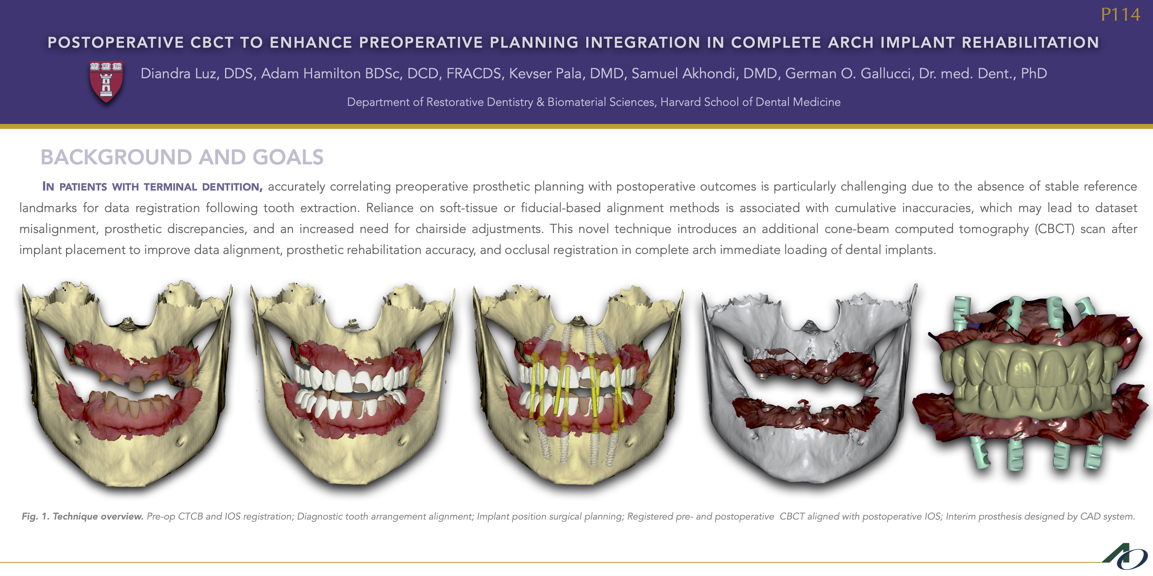 Utilizing Post-operative CBCT to Enhance Pre-operative Planning Integration in Full-arch Implant Rehabilitation