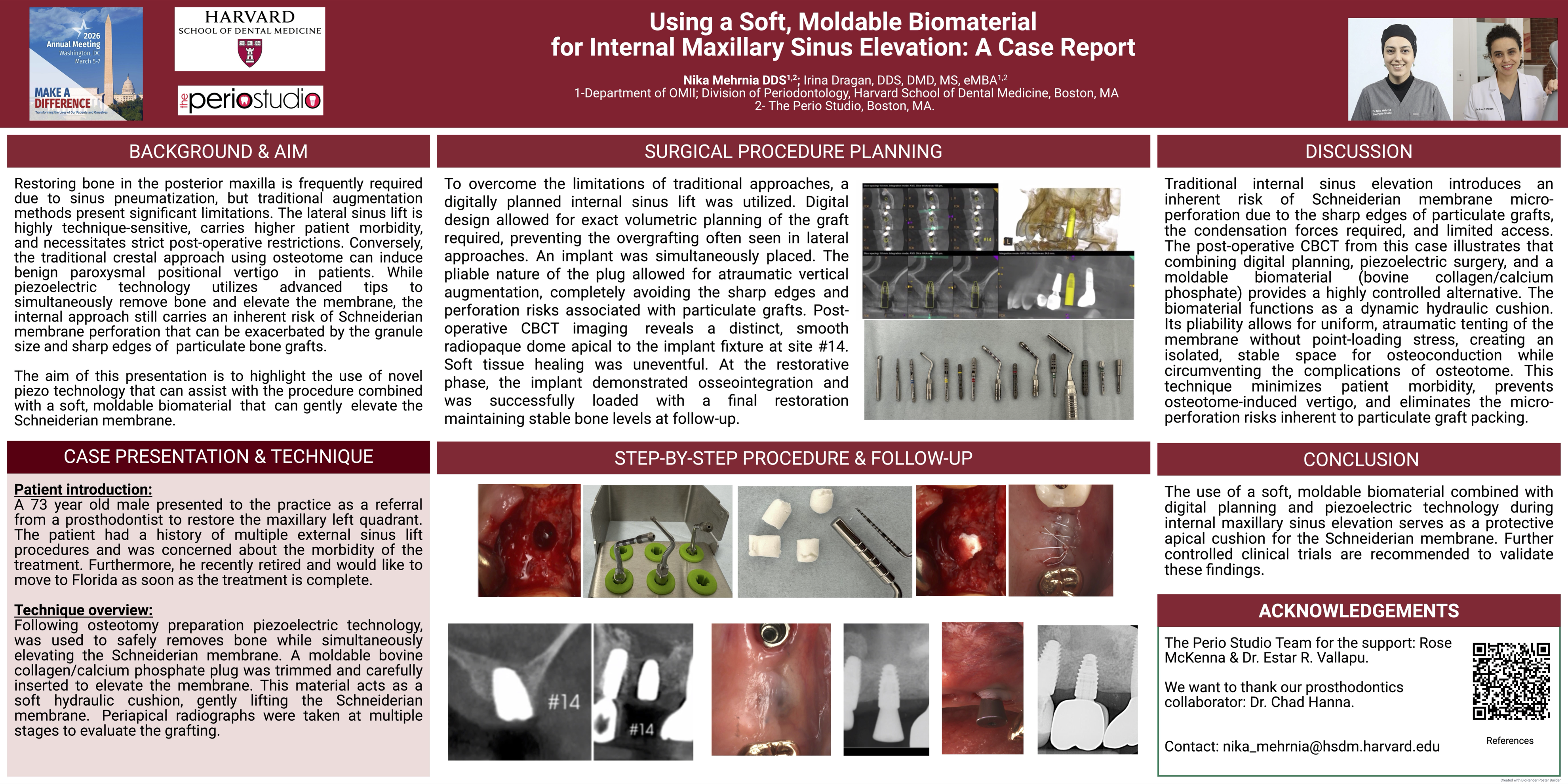 Using a Soft, Moldable Biomaterial for Internal Maxillary Sinus Elevation: A Case Report