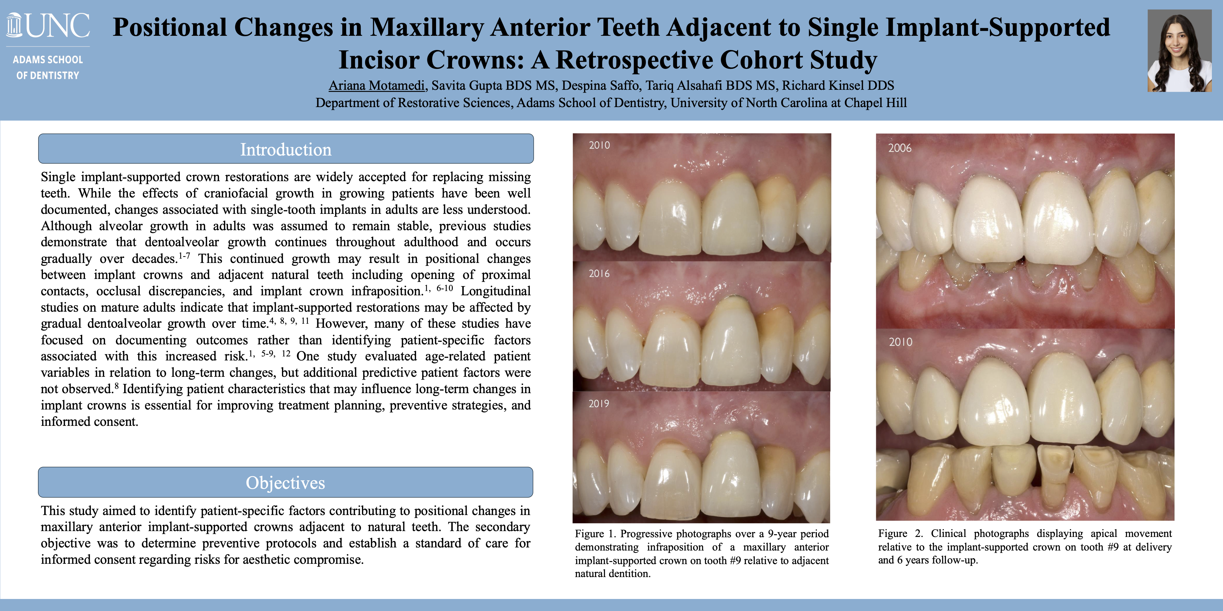 Positional Changes in Maxillary Anterior Teeth Adjacent to Single Implant-supported Incisor Crowns: A Retrospective Cohort Study