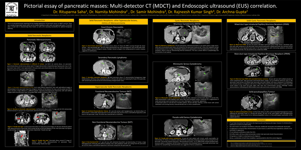 Evaluation of pancreatic masses: Multi-detector CT and Endoscopic ...